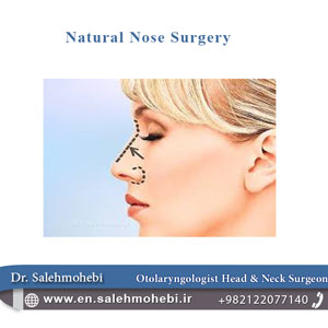 natural nose surgery